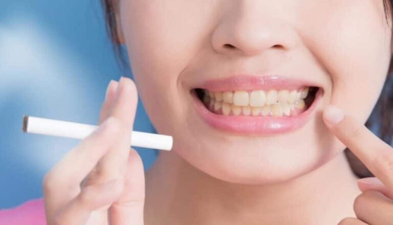 Bio smile polvere dentifricia ai carboni attivi recensioni